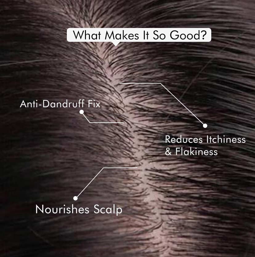 Anti-Dandruff Cappuccino Scalp Lotion with Natural AHA - 100ml
