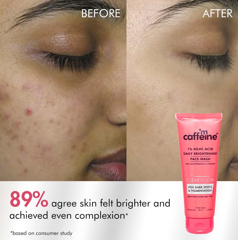 CLEAR GLOW 1% Kojic Acid Daily Brightening Face Wash For Dark Spots & Pigmentation - 100ml